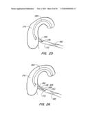 Medical Devices and Methods diagram and image