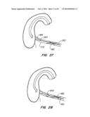 Medical Devices and Methods diagram and image