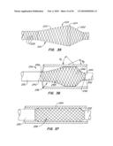 Medical Devices and Methods diagram and image