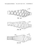 Medical Devices and Methods diagram and image