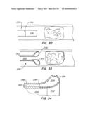 Medical Devices and Methods diagram and image