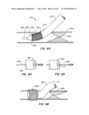 Medical Devices and Methods diagram and image