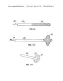 Medical Devices and Methods diagram and image