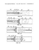 Medical Devices and Methods diagram and image