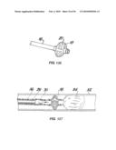 Medical Devices and Methods diagram and image