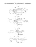 Medical Devices and Methods diagram and image