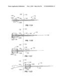 Medical Devices and Methods diagram and image