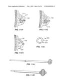 Medical Devices and Methods diagram and image