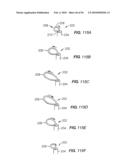 Medical Devices and Methods diagram and image