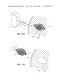 Medical Devices and Methods diagram and image