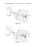 Medical Devices and Methods diagram and image