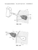 Medical Devices and Methods diagram and image