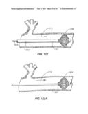 Medical Devices and Methods diagram and image