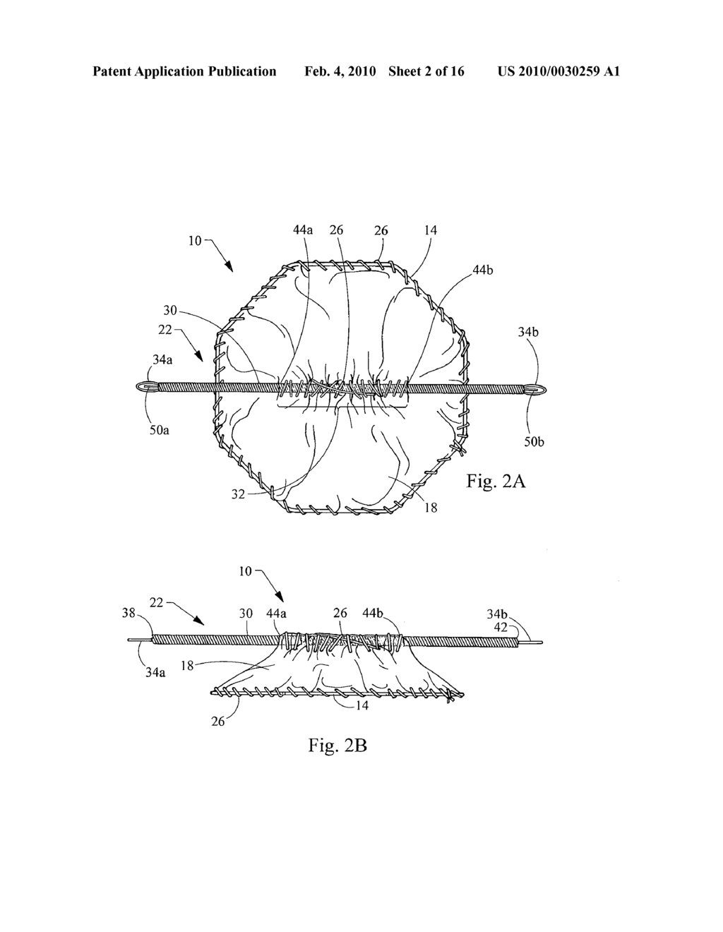 Closure Device and Method of Closing a Bodily Opening - diagram, schematic, and image 03