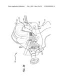 ANCHOR DELIVERY SYSTEM WITH REPLACEABLE CARTRIDGE diagram and image