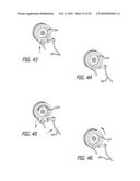 ANCHOR DELIVERY SYSTEM WITH REPLACEABLE CARTRIDGE diagram and image