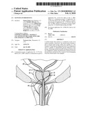 SLOTTED ANCHOR DEVICE diagram and image