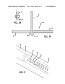 SLOTTED ANCHOR DEVICE diagram and image