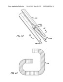 SLOTTED ANCHOR DEVICE diagram and image