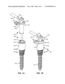 SURGICAL TOOL AND METHOD FOR IMPLANTATION OF A DYNAMIC BONE ANCHOR diagram and image