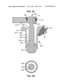 SURGICAL TOOL AND METHOD FOR IMPLANTATION OF A DYNAMIC BONE ANCHOR diagram and image