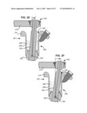 SURGICAL TOOL AND METHOD FOR IMPLANTATION OF A DYNAMIC BONE ANCHOR diagram and image