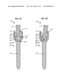 SURGICAL TOOL AND METHOD FOR IMPLANTATION OF A DYNAMIC BONE ANCHOR diagram and image