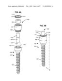 SURGICAL TOOL AND METHOD FOR IMPLANTATION OF A DYNAMIC BONE ANCHOR diagram and image