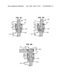 SURGICAL TOOL AND METHOD FOR IMPLANTATION OF A DYNAMIC BONE ANCHOR diagram and image