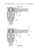 SURGICAL TOOL AND METHOD FOR IMPLANTATION OF A DYNAMIC BONE ANCHOR diagram and image