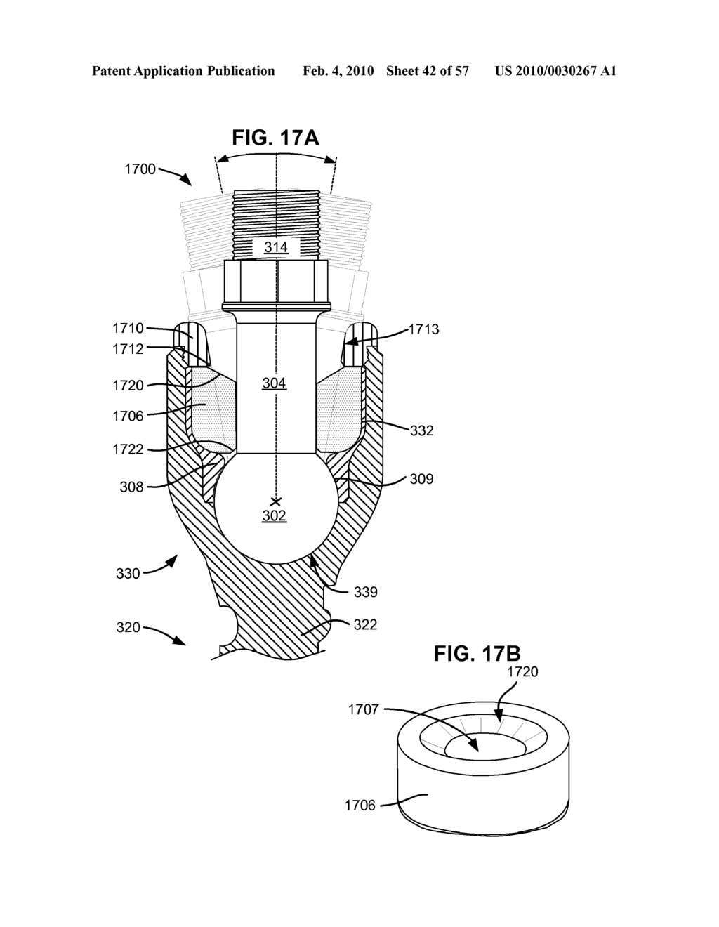 SURGICAL TOOL AND METHOD FOR IMPLANTATION OF A DYNAMIC BONE ANCHOR - diagram, schematic, and image 43