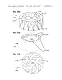 SURGICAL TOOL AND METHOD FOR IMPLANTATION OF A DYNAMIC BONE ANCHOR diagram and image