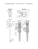 SURGICAL TOOL AND METHOD FOR IMPLANTATION OF A DYNAMIC BONE ANCHOR diagram and image