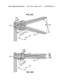 SURGICAL TOOL AND METHOD FOR IMPLANTATION OF A DYNAMIC BONE ANCHOR diagram and image