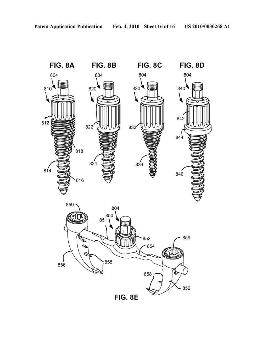 LOAD-SHARING ANCHOR HAVING A DEFLECTABLE POST AND CENTERING SPRING AND METHOD FOR DYNAMIC STABILIZATION OF THE SPINE - diagram, schematic, and image 17