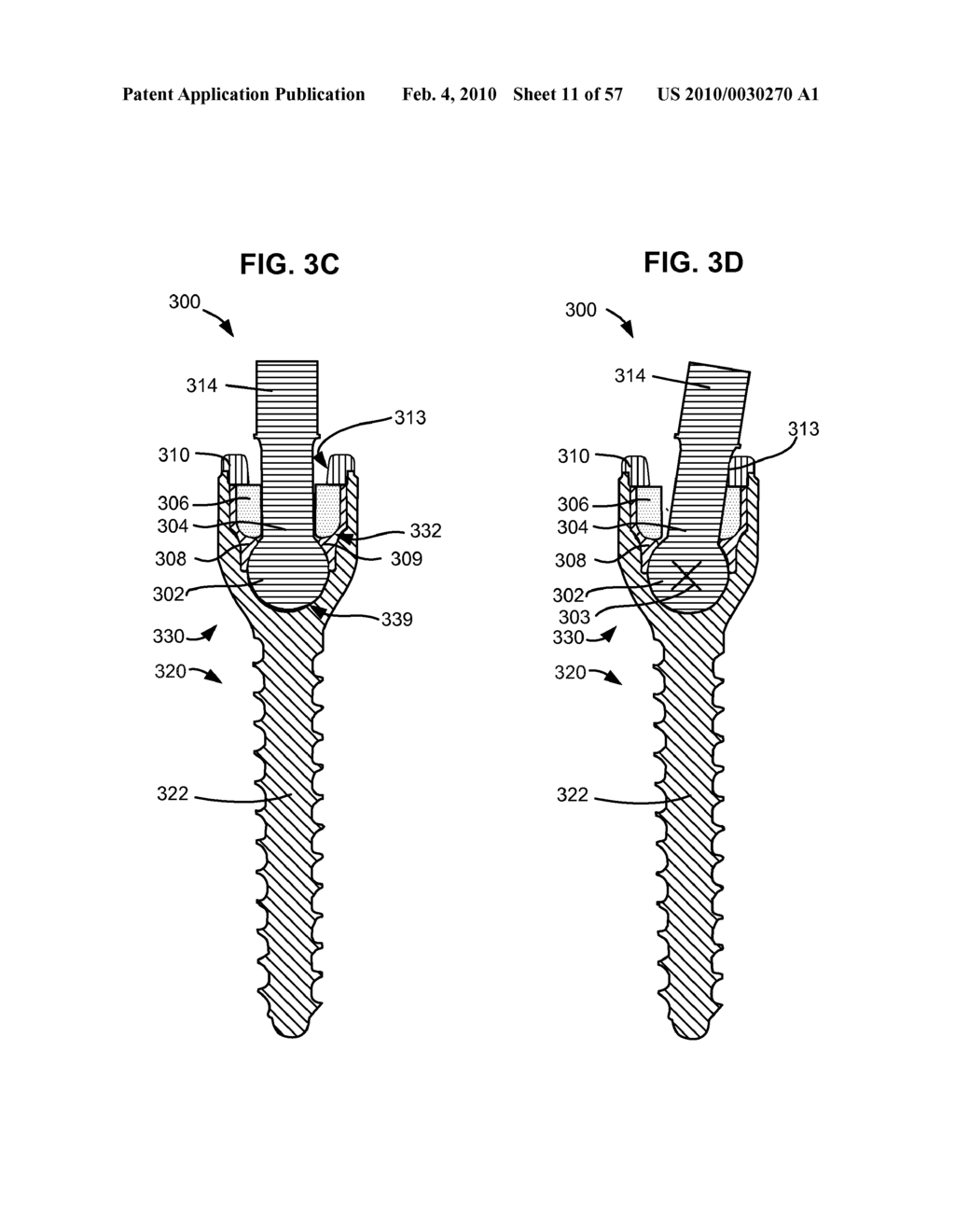 DYNAMIC SPINAL ROD ASSEMBLY AND METHOD FOR DYNAMIC STABILIZATION OF THE SPINE - diagram, schematic, and image 12