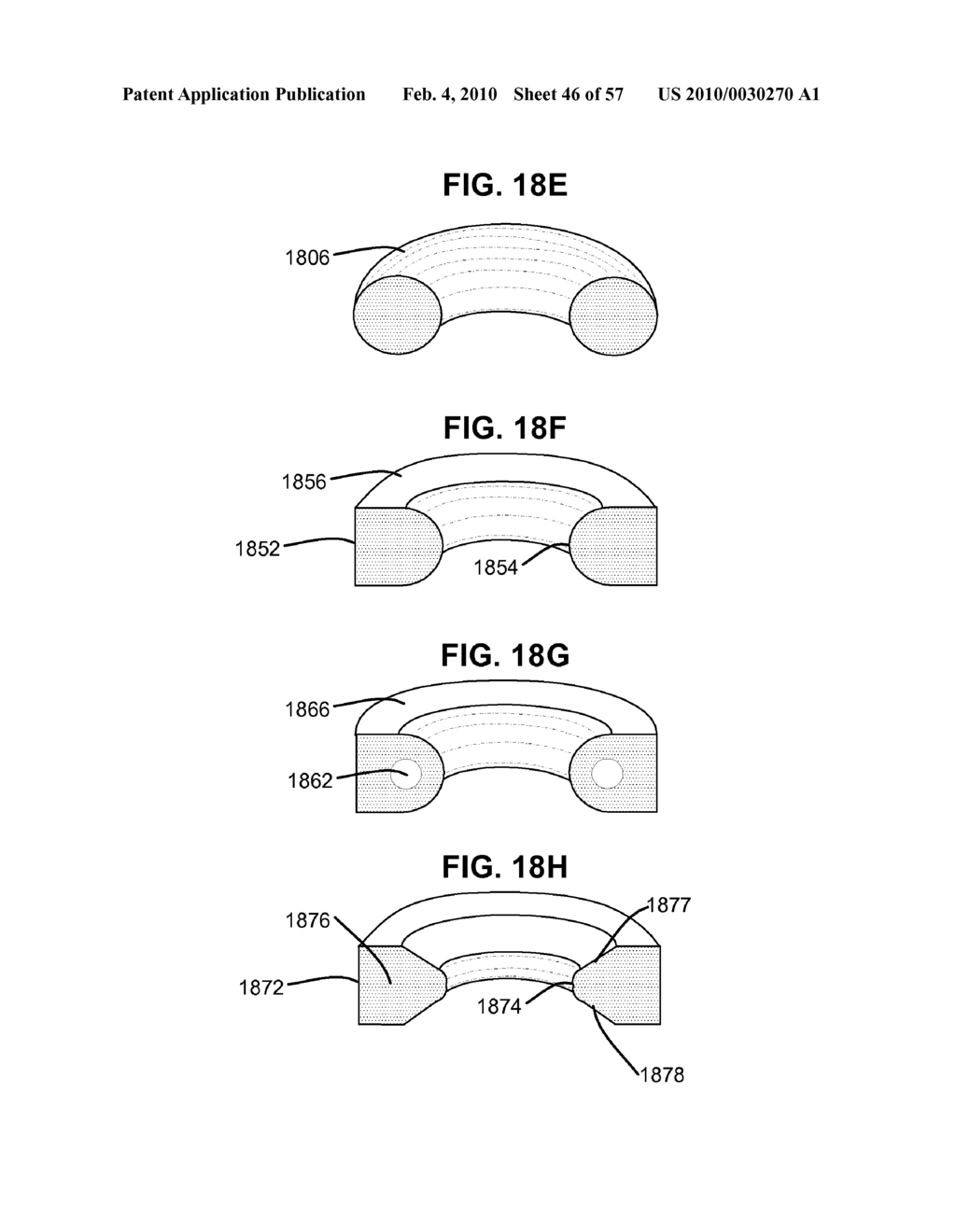 DYNAMIC SPINAL ROD ASSEMBLY AND METHOD FOR DYNAMIC STABILIZATION OF THE SPINE - diagram, schematic, and image 47