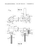 MODULAR IN-LINE DEFLECTION ROD AND BONE ANCHOR SYSTEM AND METHOD FOR DYNAMIC STABILIZATION OF THE SPINE diagram and image