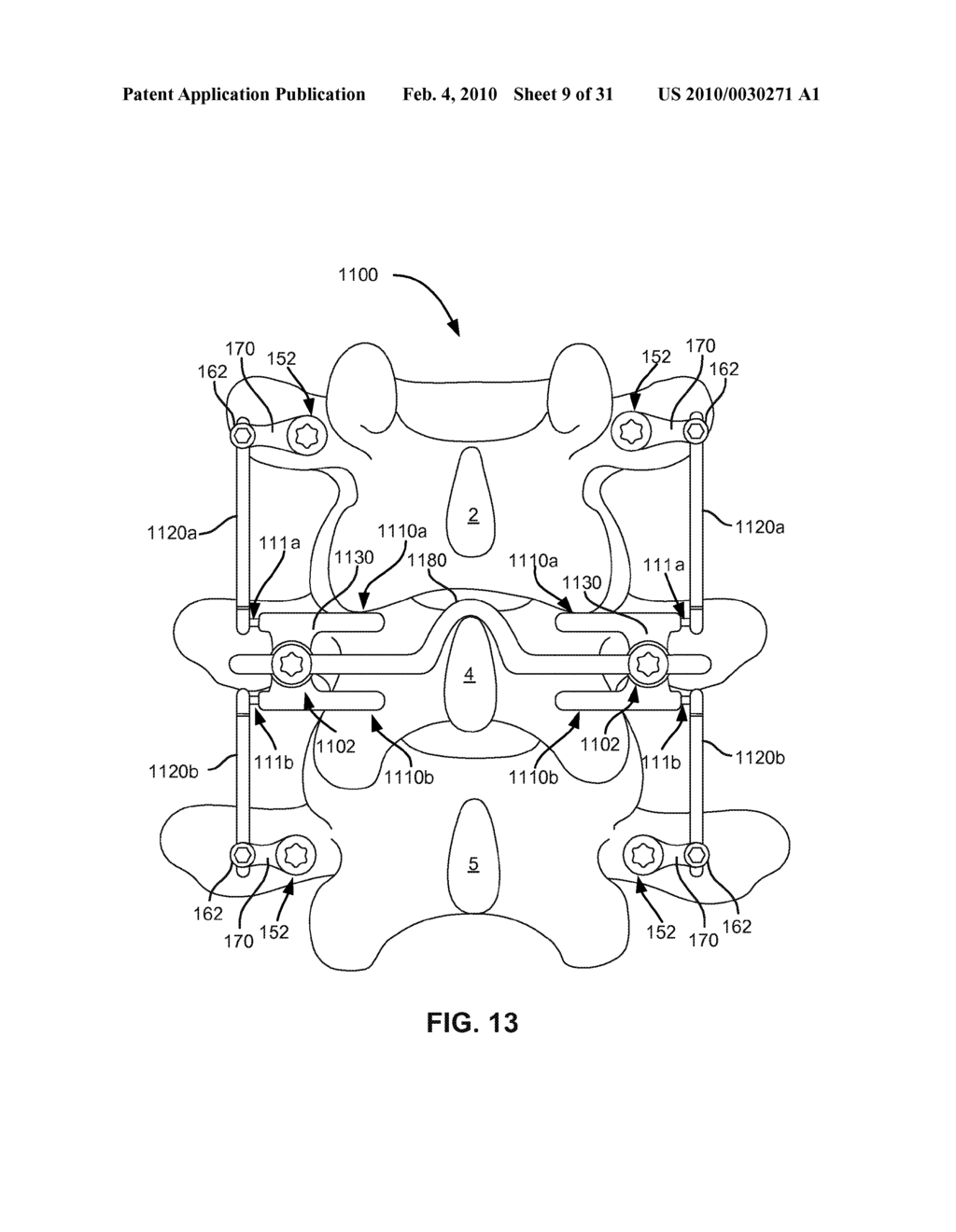 MODULAR IN-LINE DEFLECTION ROD AND BONE ANCHOR SYSTEM AND METHOD FOR DYNAMIC STABILIZATION OF THE SPINE - diagram, schematic, and image 10