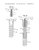 MODULAR IN-LINE DEFLECTION ROD AND BONE ANCHOR SYSTEM AND METHOD FOR DYNAMIC STABILIZATION OF THE SPINE diagram and image