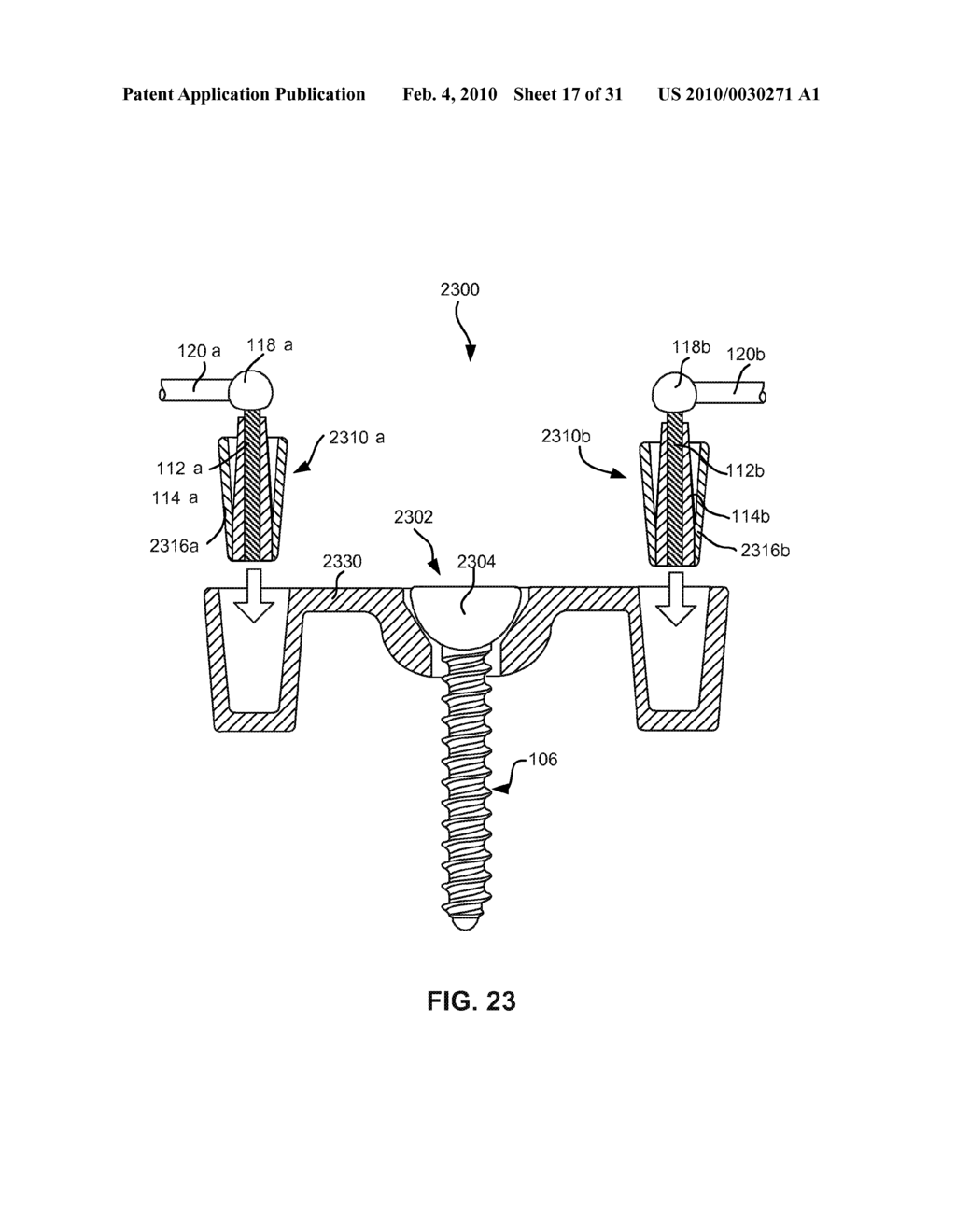 MODULAR IN-LINE DEFLECTION ROD AND BONE ANCHOR SYSTEM AND METHOD FOR DYNAMIC STABILIZATION OF THE SPINE - diagram, schematic, and image 18