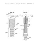 MODULAR IN-LINE DEFLECTION ROD AND BONE ANCHOR SYSTEM AND METHOD FOR DYNAMIC STABILIZATION OF THE SPINE diagram and image