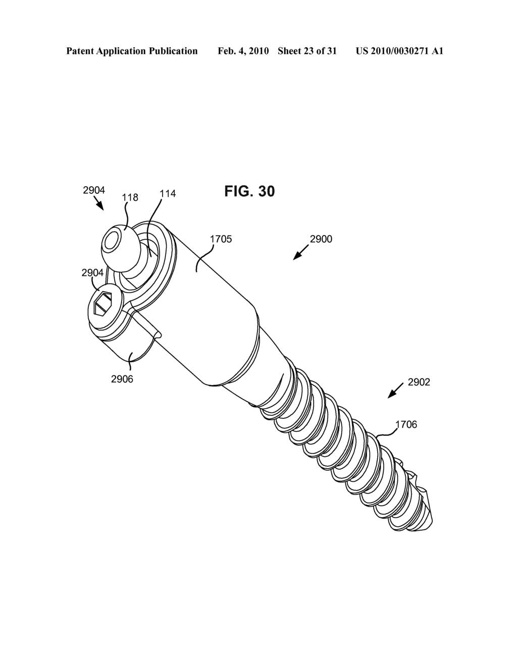 MODULAR IN-LINE DEFLECTION ROD AND BONE ANCHOR SYSTEM AND METHOD FOR DYNAMIC STABILIZATION OF THE SPINE - diagram, schematic, and image 24