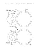 MODULAR IN-LINE DEFLECTION ROD AND BONE ANCHOR SYSTEM AND METHOD FOR DYNAMIC STABILIZATION OF THE SPINE diagram and image