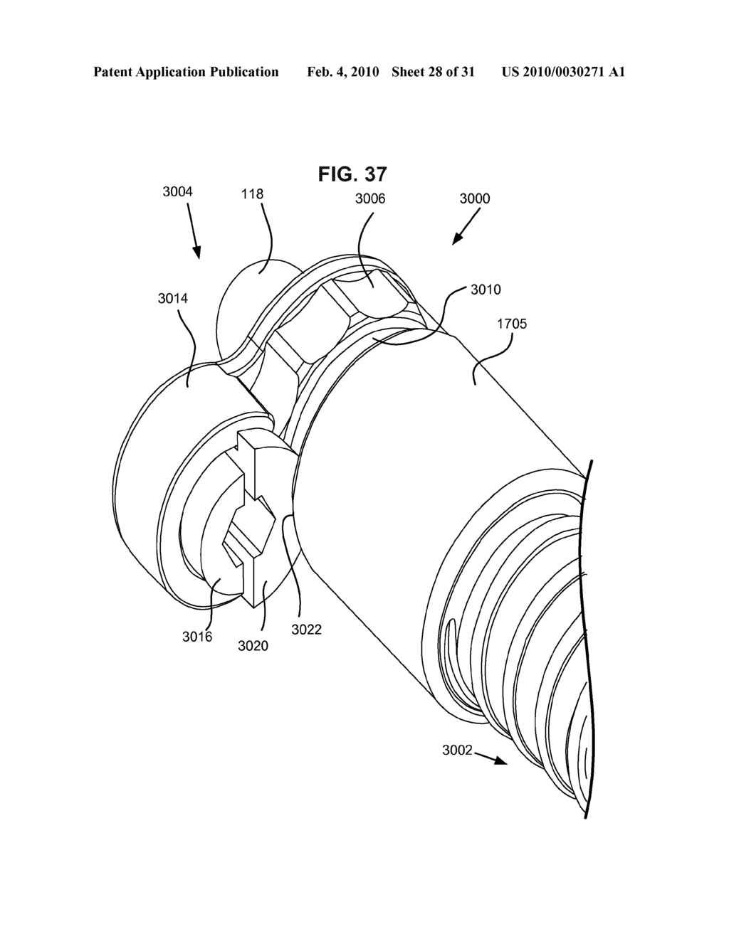 MODULAR IN-LINE DEFLECTION ROD AND BONE ANCHOR SYSTEM AND METHOD FOR DYNAMIC STABILIZATION OF THE SPINE - diagram, schematic, and image 29