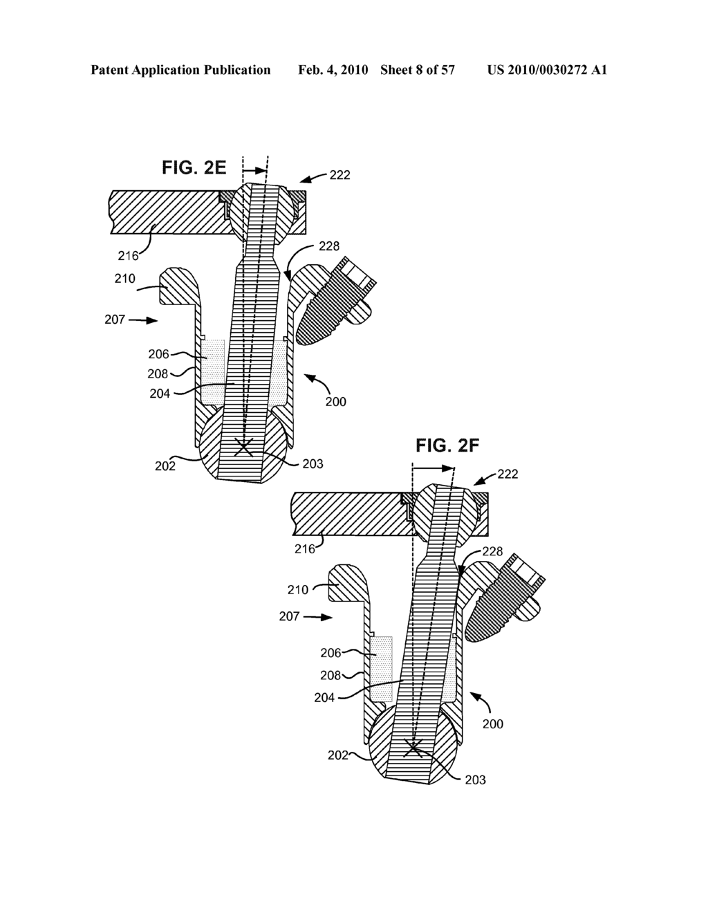 SPINAL PROSTHESIS HAVING A THREE BAR LINKAGE FOR MOTION PRESERVATION AND DYNAMIC STABILIZATION OF THE SPINE - diagram, schematic, and image 09