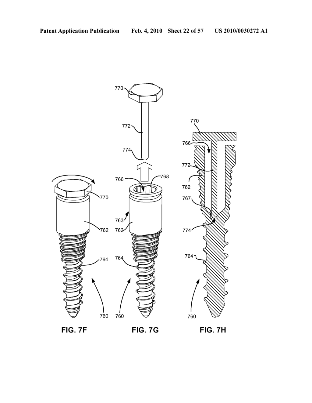 SPINAL PROSTHESIS HAVING A THREE BAR LINKAGE FOR MOTION PRESERVATION AND DYNAMIC STABILIZATION OF THE SPINE - diagram, schematic, and image 23