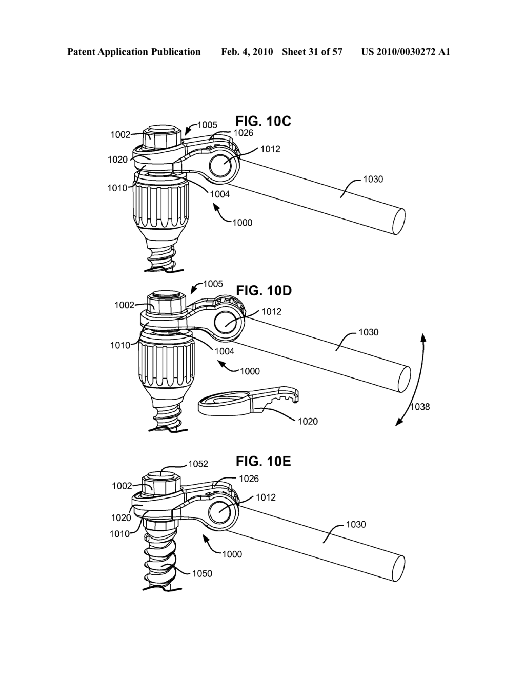 SPINAL PROSTHESIS HAVING A THREE BAR LINKAGE FOR MOTION PRESERVATION AND DYNAMIC STABILIZATION OF THE SPINE - diagram, schematic, and image 32