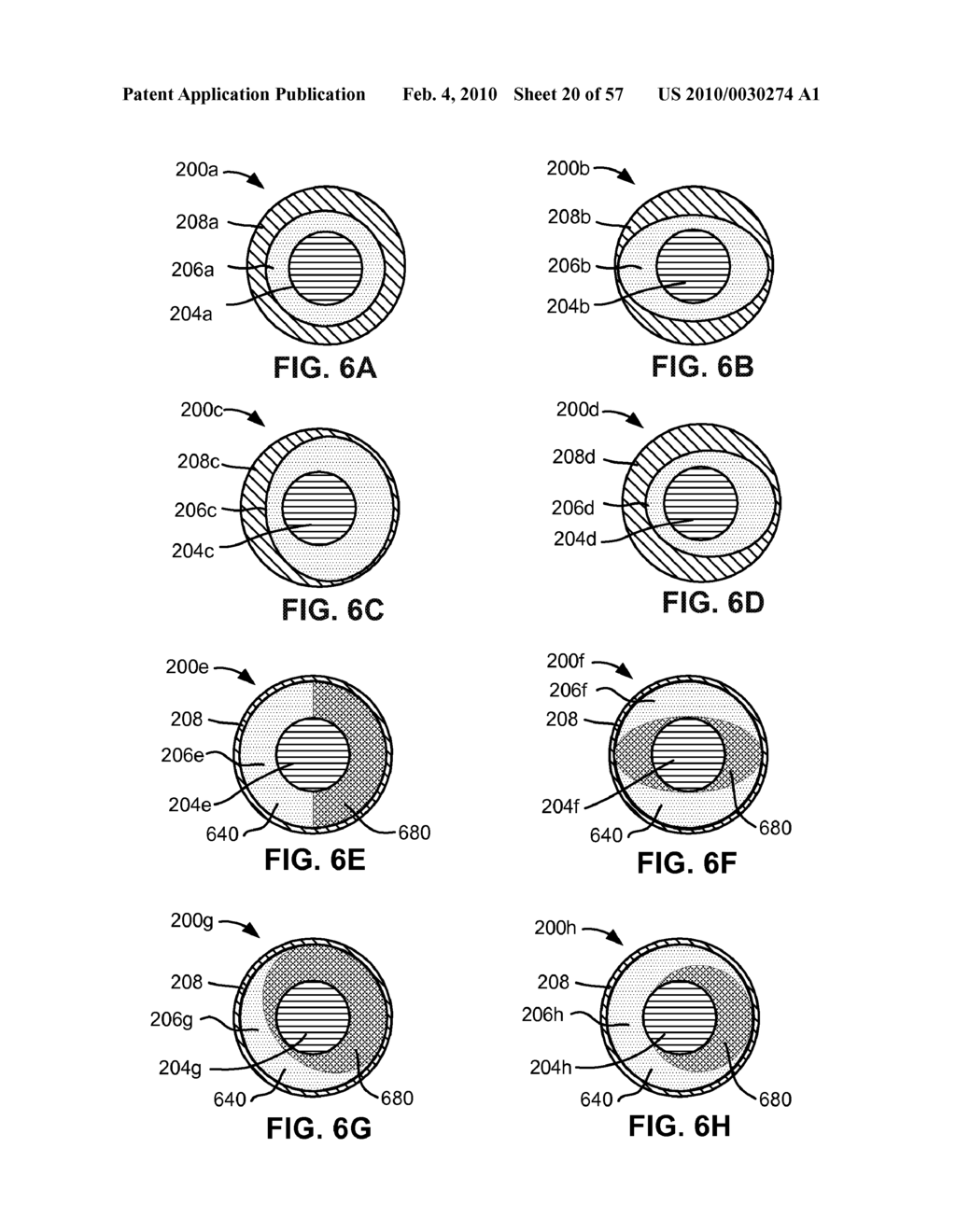 DYNAMIC SPINAL ROD AND METHOD FOR DYNAMIC STABILIZATION OF THE SPINE - diagram, schematic, and image 21