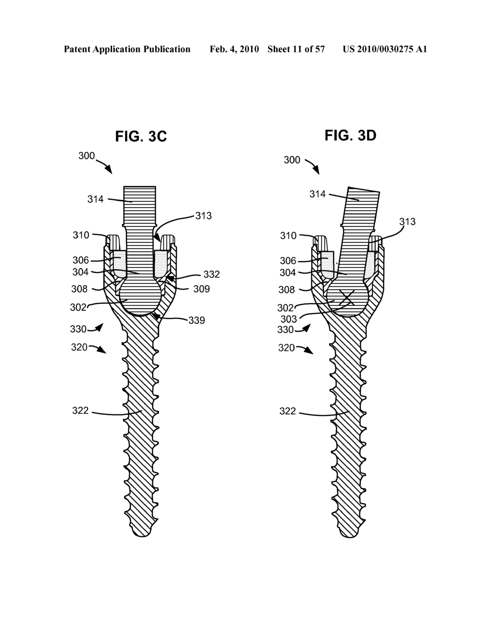 CONFIGURABLE DYNAMIC SPINAL ROD AND METHOD FOR DYNAMIC STABILIZATION OF THE SPINE - diagram, schematic, and image 12